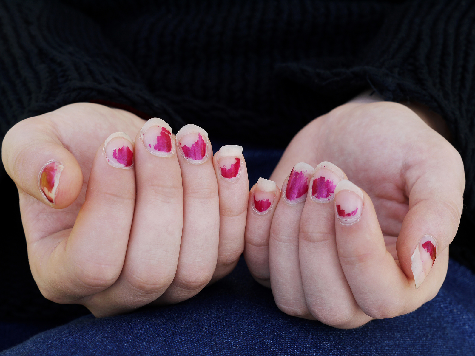The sign of poor nail health, how to remedy it